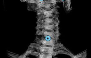 Diagnostic