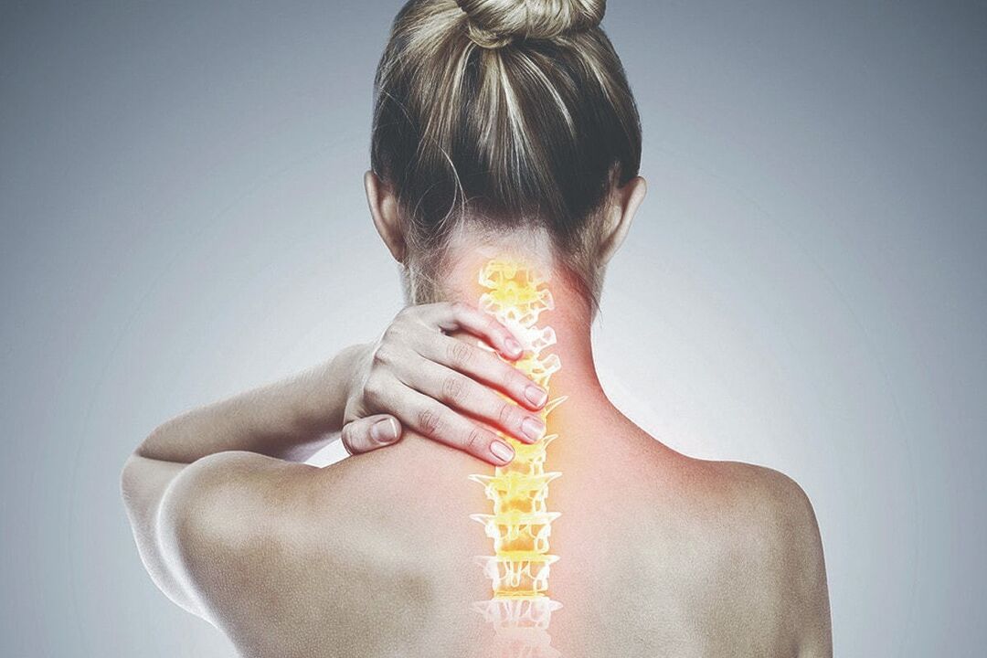 Osteochondroza cervicală
