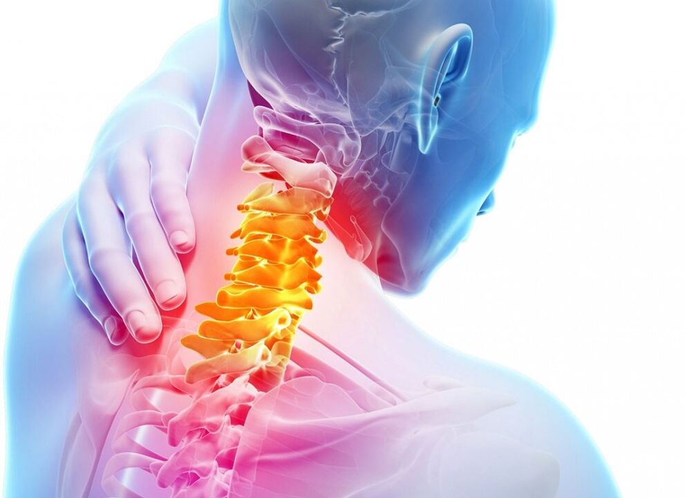 Ce este osteocondroza cervicală