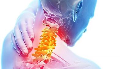 Cauzele osteochondrozei cervicale