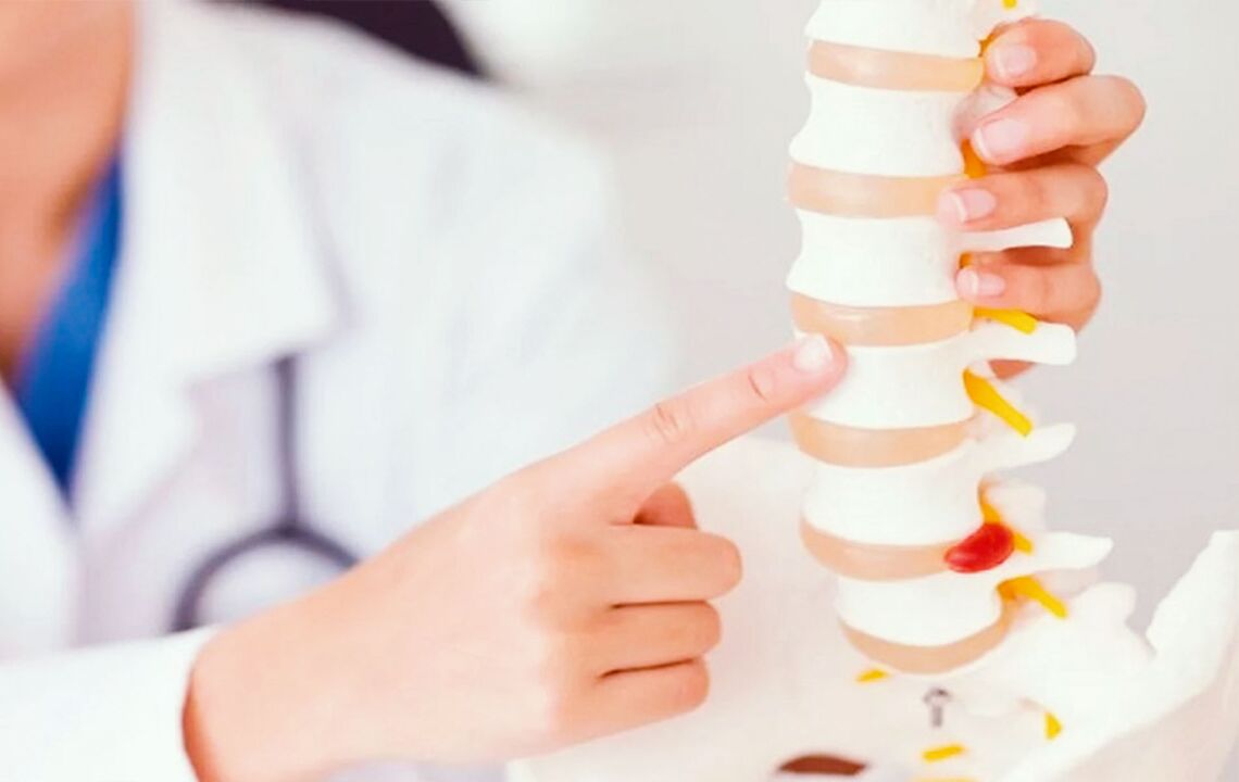 afectarea coloanei vertebrale din cauza osteocondrozei cervicale