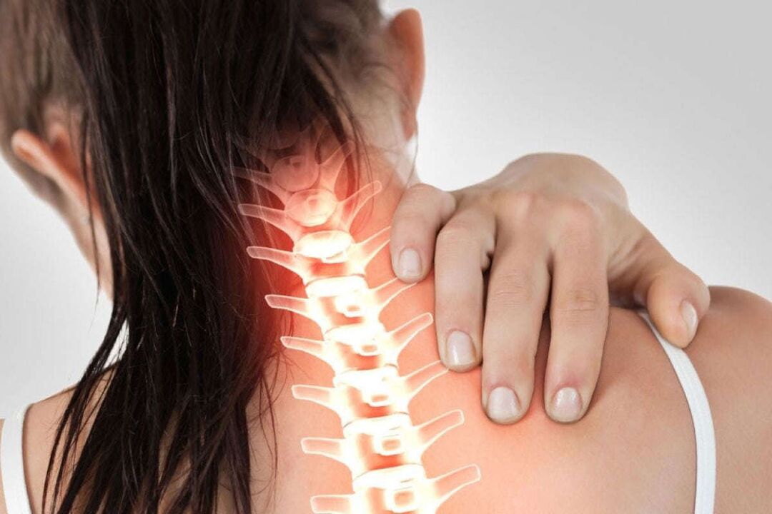 Manifestări ale osteochondrozei cervicale
